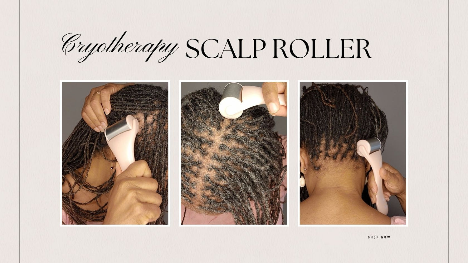 How I Solved My Scalp Issues with the Cryotherapy Scalp Roller
