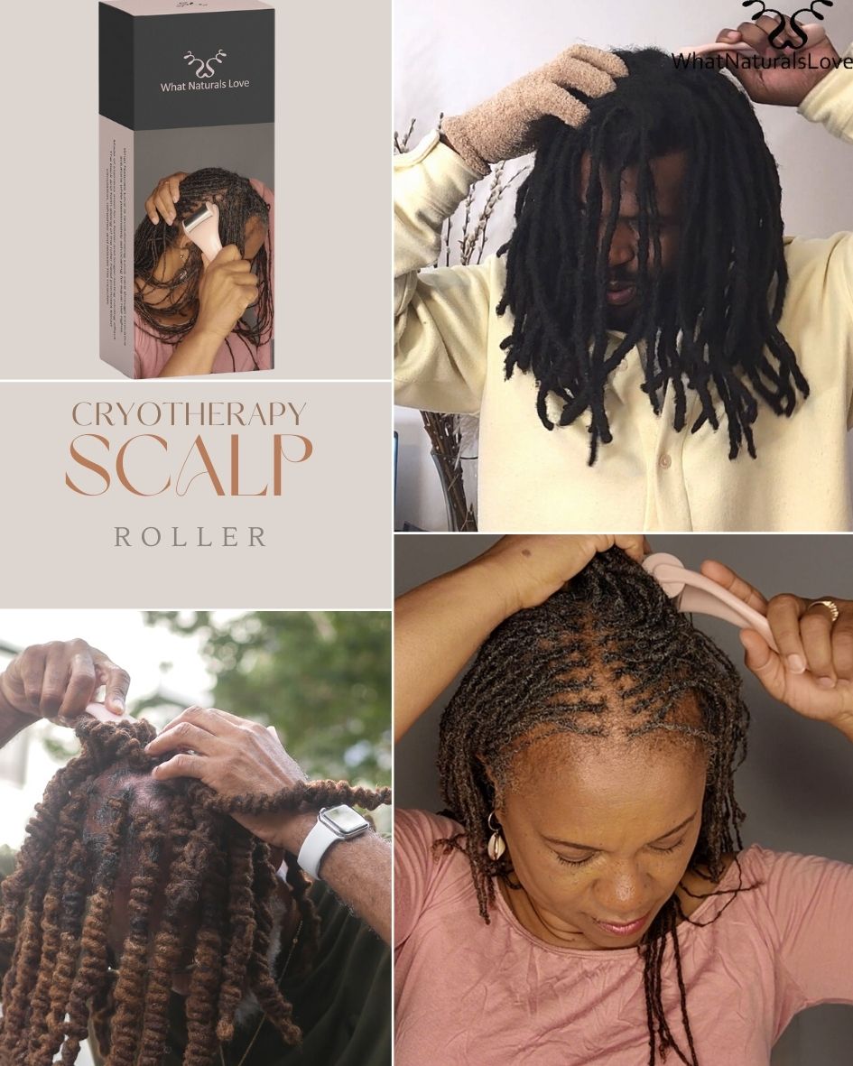 Back view of braided hairstyle showcasing a healthy scalp, emphasizing the benefits of cryotherapy scalp care.