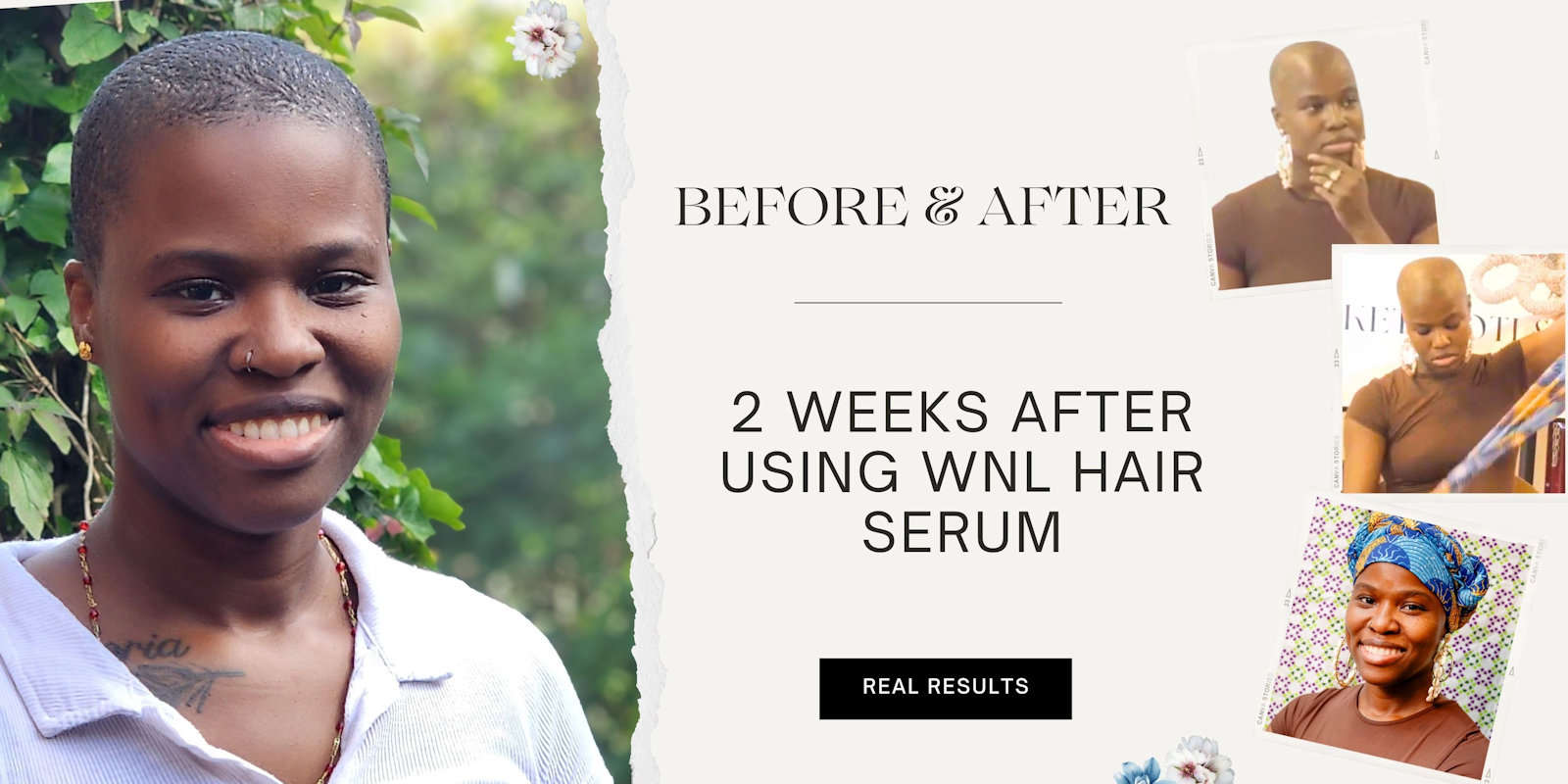 Before and after comparison of a person using WNL hair serum, with text indicating results and additional images of the person.