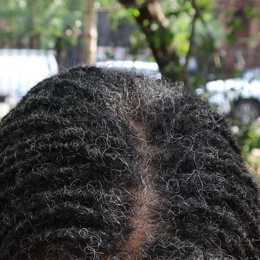 Moisturizing Scalp Serum For Locs Dreadlocks Sisterlocks Micro Locs 