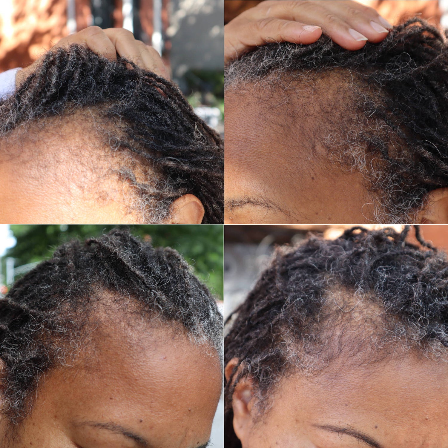 Hair Growth Tea to restore follicles and boost growth